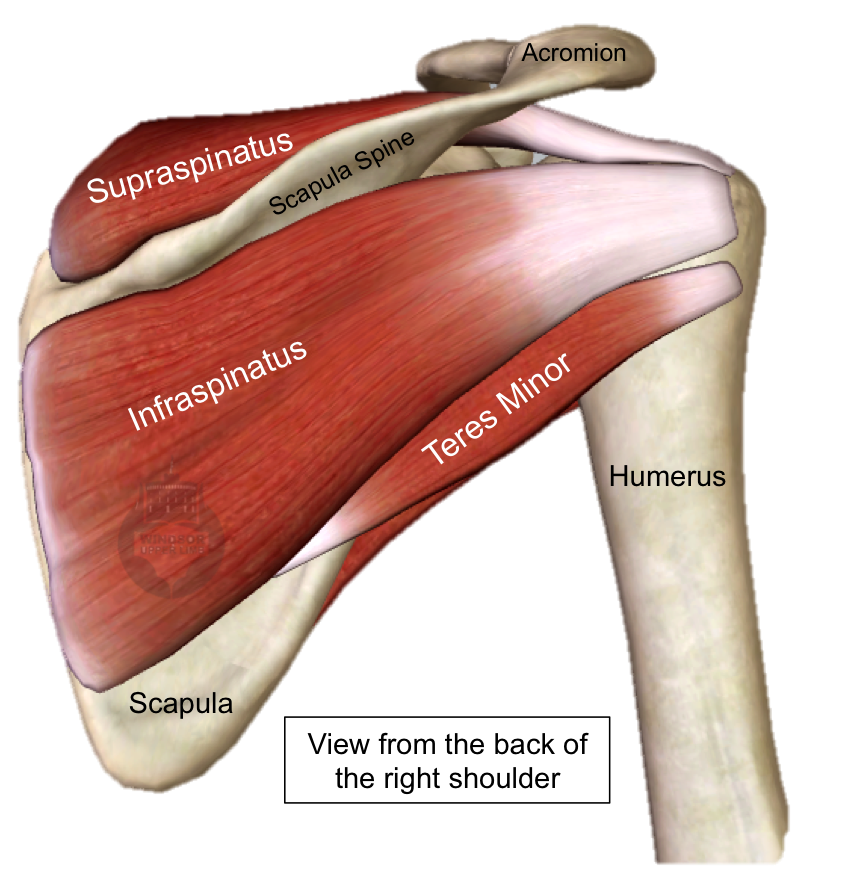 Subscapularis Tear In Muscle 56